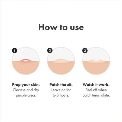 Chin Acne Patch for Day and Night Use - Repair Acne Effectively